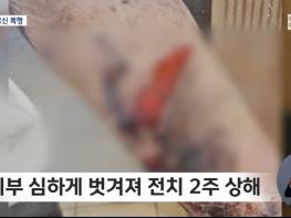 제주 요양원 폭행 사건으로 본 '스킨테어' 위험성과 노인학대 예방 기사 이미지