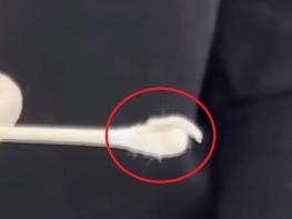 요양병원 중증 환자 코·입에서 구더기 추정 물체 발견… 보건당국 조사 착수 기사 이미지